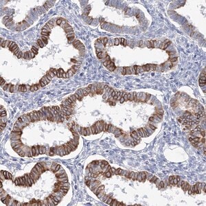 Merck Anti-LRRIQ4 antibody produced in rabbit