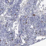 Merck Anti-FBXW12 antibody produced in rabbit