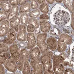 Merck Anti-ELP4 antibody produced in rabbit