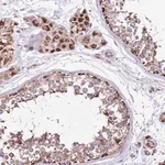 Merck Anti-HECTD4 antibody produced in rabbit