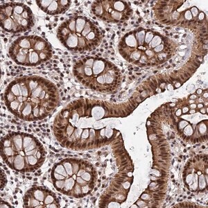 Merck Anti-ERCC5 antibody produced in rabbit