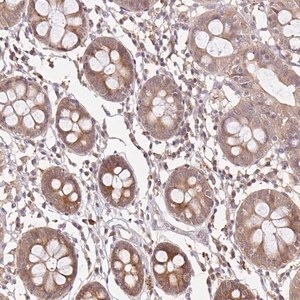 Merck Anti-LARS2 antibody produced in rabbit