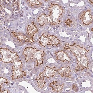 Merck Anti-EME2 antibody produced in rabbit