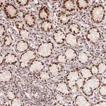 Merck Anti-MECOM antibody produced in rabbit