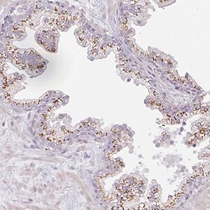 Merck Anti-ATP8B2 antibody produced in rabbit