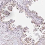 Merck Anti-ATP8B2 antibody produced in rabbit