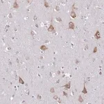 Merck Anti-ST8SIA5 antibody produced in rabbit