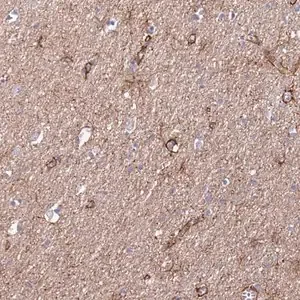 Merck Anti-JAKMIP2 antibody produced in rabbit