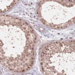 Merck Anti-VPS52 antibody produced in rabbit