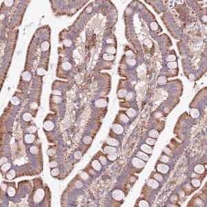 Merck Anti-ARMCX6 antibody produced in rabbit