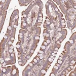 Merck Anti-ARMCX6 antibody produced in rabbit