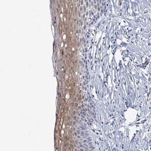 Merck Anti-DCAF5 antibody produced in rabbit