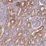 Merck Anti-PAPD5 antibody produced in rabbit