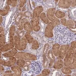 Merck Anti-GALK2 antibody produced in rabbit