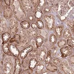 Merck Anti-ANKRD24 antibody produced in rabbit