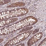 Merck Anti-VPS16 antibody produced in rabbit