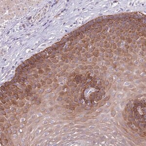 Merck Anti-ZNF658 antibody produced in rabbit