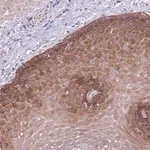 Merck Anti-ZNF658 antibody produced in rabbit