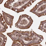 Merck Anti-WDFY3 antibody produced in rabbit