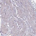 Merck Anti-NKD1 antibody produced in rabbit