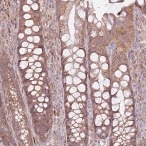 Merck Anti-MRPS6 antibody produced in rabbit