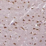 Merck Anti-COX18 antibody produced in rabbit