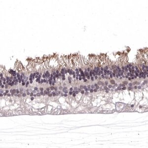 Merck Anti-RGS9BP antibody produced in rabbit