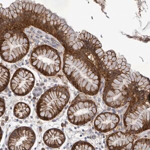 Merck Anti-ATP13A1 antibody produced in rabbit
