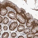 Merck Anti-ATP13A1 antibody produced in rabbit