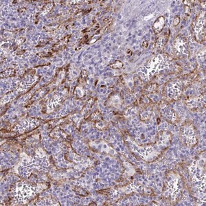 Merck Anti-KRIT1 antibody produced in rabbit