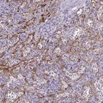 Merck Anti-KRIT1 antibody produced in rabbit