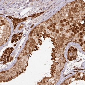 Merck Anti-RANBP9 antibody produced in rabbit