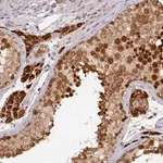 Merck Anti-RANBP9 antibody produced in rabbit