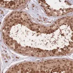 Merck Anti-SRA1 antibody produced in rabbit