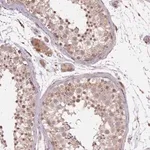 Merck Anti-POLR3F antibody produced in rabbit