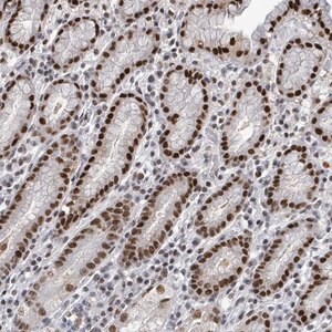 Merck Anti-ERCC5 antibody produced in rabbit