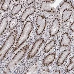 Merck Anti-ERCC5 antibody produced in rabbit