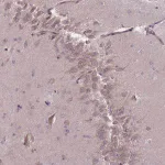 Merck Anti-PNPLA5 antibody produced in rabbit