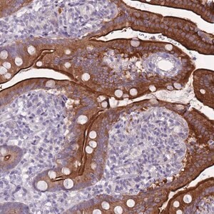 Merck Anti-HOOK2 antibody produced in rabbit