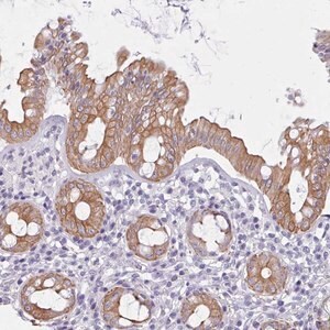 Merck Anti-FPGS antibody produced in rabbit