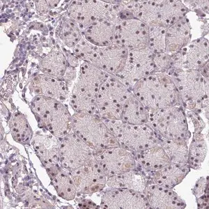 Merck Anti-UVSSA antibody produced in rabbit