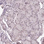 Merck Anti-UVSSA antibody produced in rabbit
