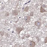 Merck Anti-RTP5 antibody produced in rabbit