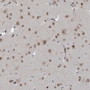 Merck Anti-UCK1 antibody produced in rabbit