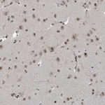 Merck Anti-UCK1 antibody produced in rabbit