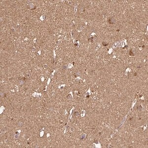 Merck Anti-ATAT1 antibody produced in rabbit