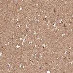 Merck Anti-ATAT1 antibody produced in rabbit