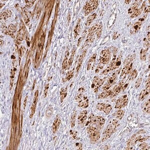 Merck Anti-TARM1 antibody produced in rabbit