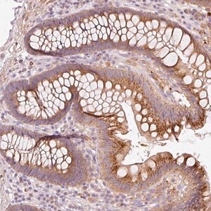 Merck Anti-KLHL21 antibody produced in rabbit
