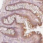 Merck Anti-KLHL21 antibody produced in rabbit